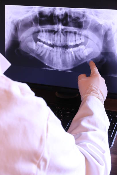 Best Emergency Root Canal Treatment in Ware Shoals, SC